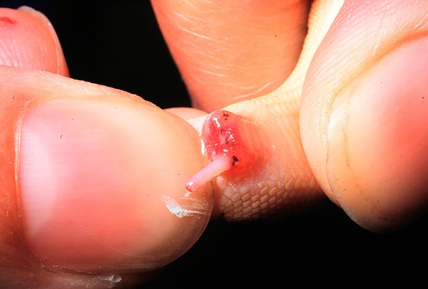 Popping a male sand boa baby: This is illustrated by the closeup view of the cloaca of a newborn East African sandboa being popped to determine sex. The hand on the right side of the photo holds the body, while the thumb of the hand on the left side of the photo applies pressure to the base of the tail. One of the tiny hemipenes is shown fully everted, demonstrating without a doubt that this is a male. More pressure would evert the second hemipenis, but this is unnecessary.
